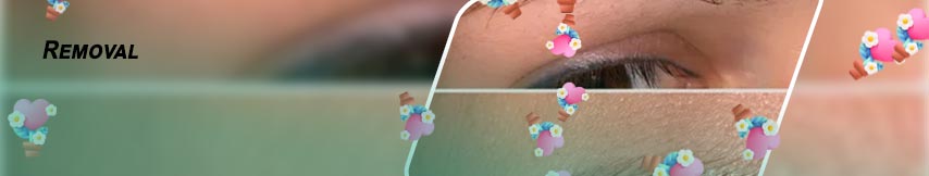 Remove eyebrow microblading